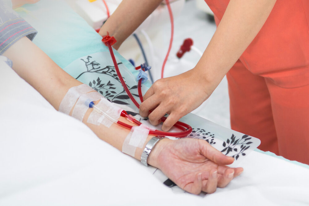 Hemodialysis,Machines,With,Tubing.,transplantation,medical,Equipment,Concept.