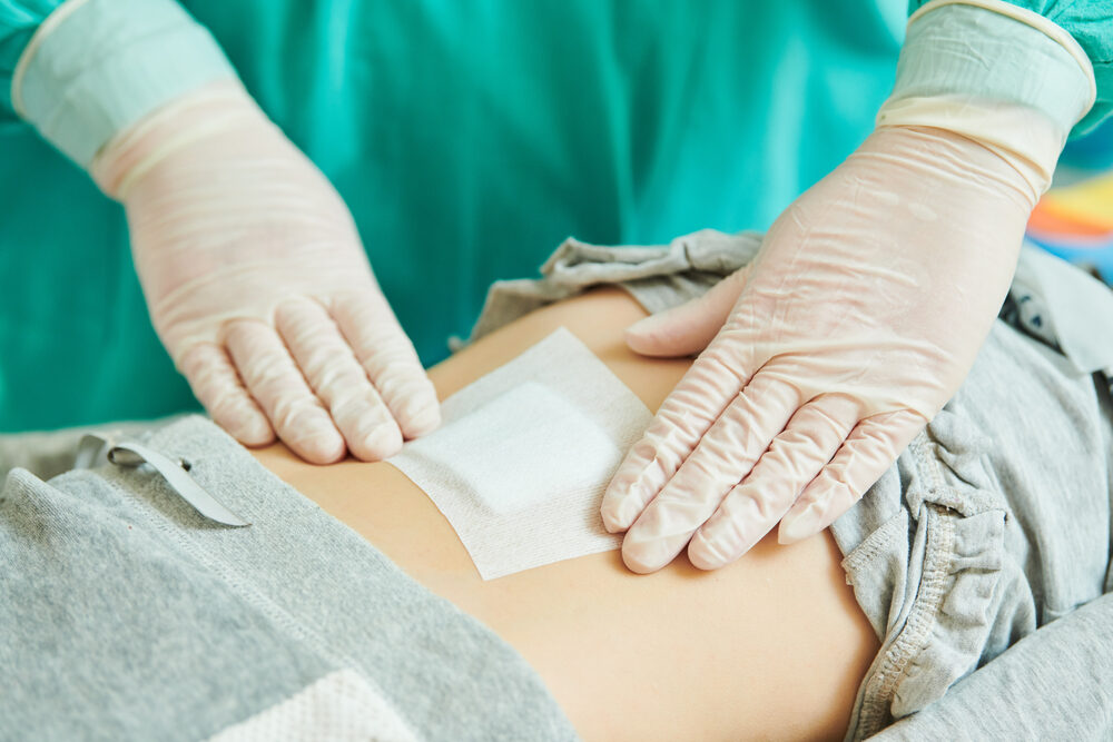 Surgeon,Applies,Bandage,On,Wound,Of,Child's,Abdomen