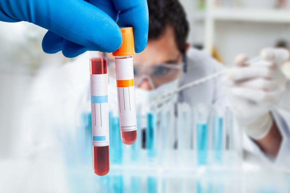 Doctor,Holding,Blood,Sample,In,Test,Tube